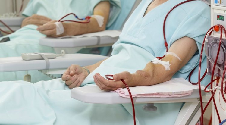 Hemodiyaliz Tedavisi Hakkında Hastaların En Çok Sorduğu Sorular