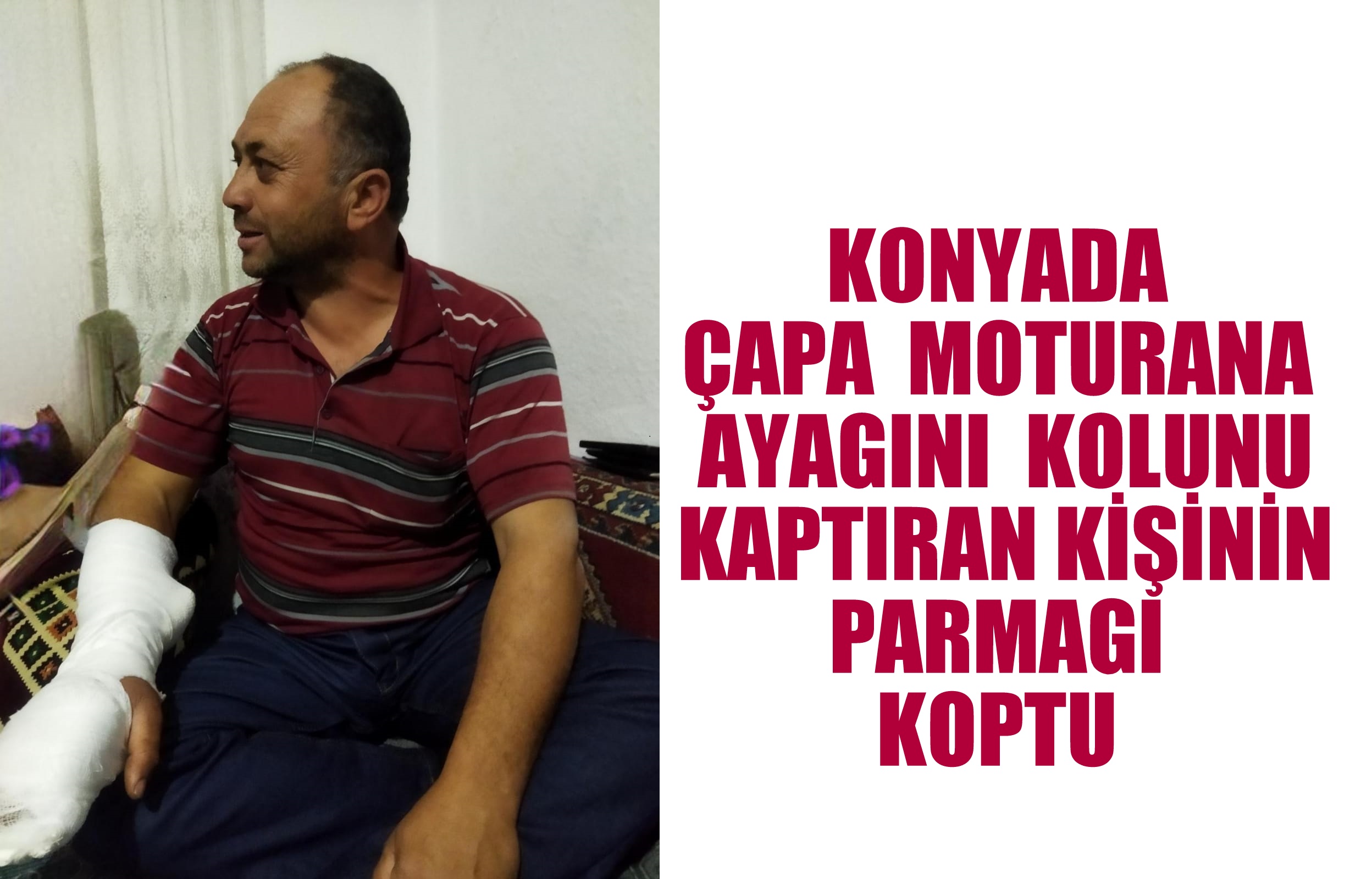 ÇAPA   MOTURANA AYAGINI  KOLUNU KAPTIRAN KİŞİNİN PARMAGI KOPTU