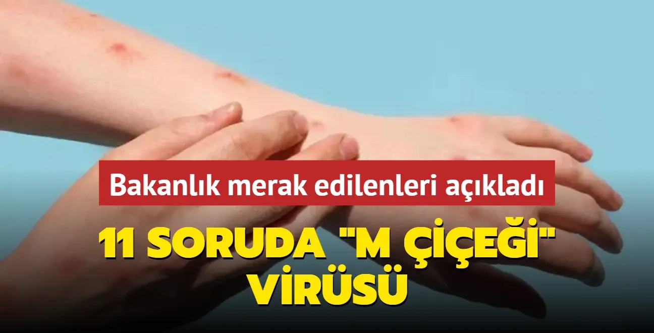 İşte 11 soruda maymun çiçeği rehberi