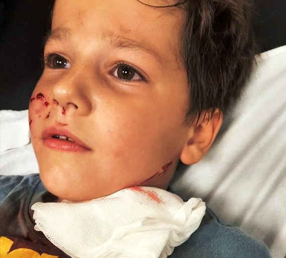 Seydişehir'de 7 yaşındaki çocuk  yaralandı