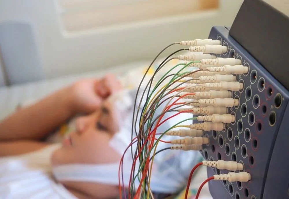 Tıp tarihinde bir ilk! Epilepsi hastası çocuk kafasına yerleştirilen cihazla iyileşti